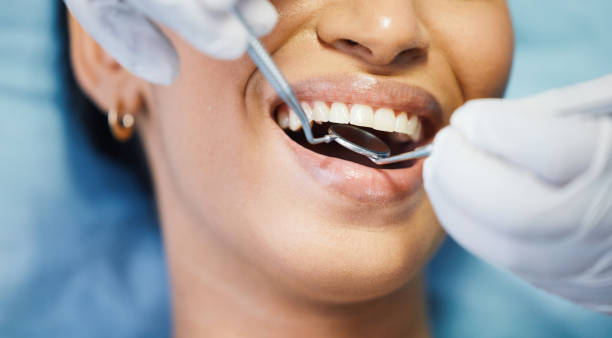 Best Emergency Denture Repair in Lattingtown, NY